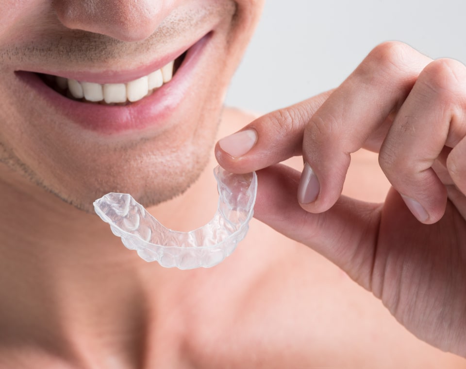 invisalign