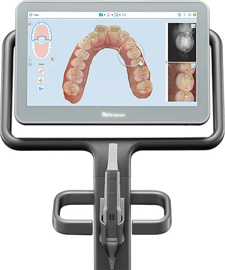 iTero Element 5D | Invisalign Scanner