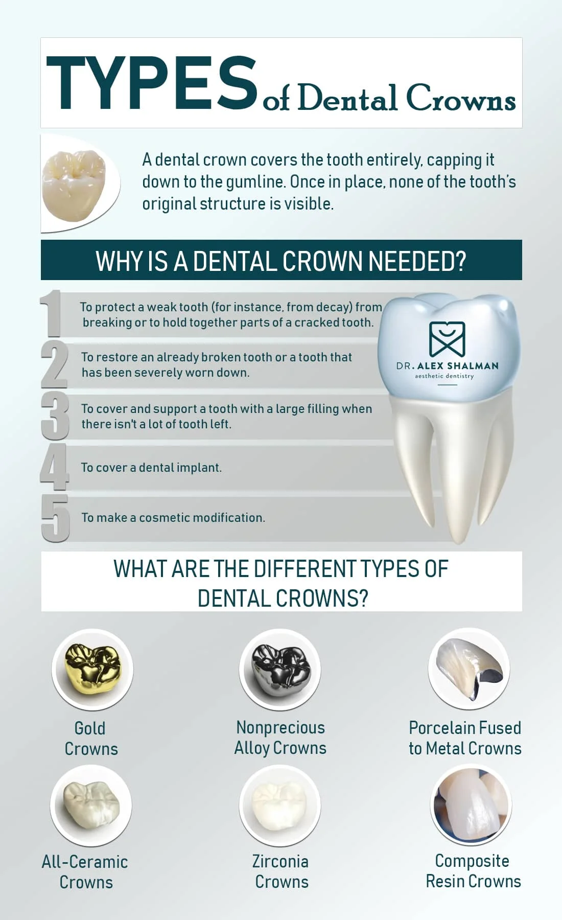 Types of Dental Crowns