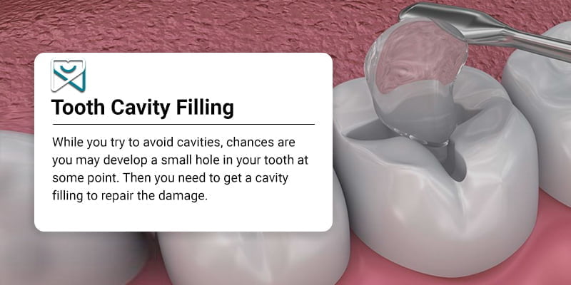 Tooth Cavity Filling