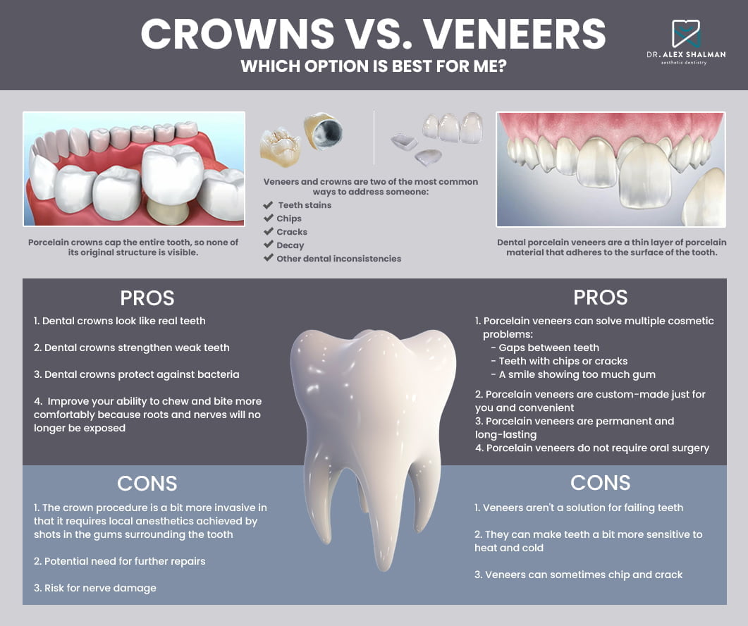 What is the Difference Between Porcelain Crowns and Veneers?