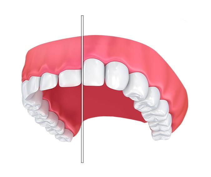 Small teeth